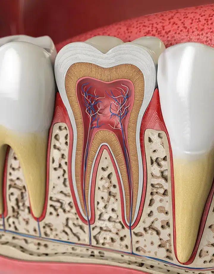 root canal therapy metairie at gallagher family dentistry