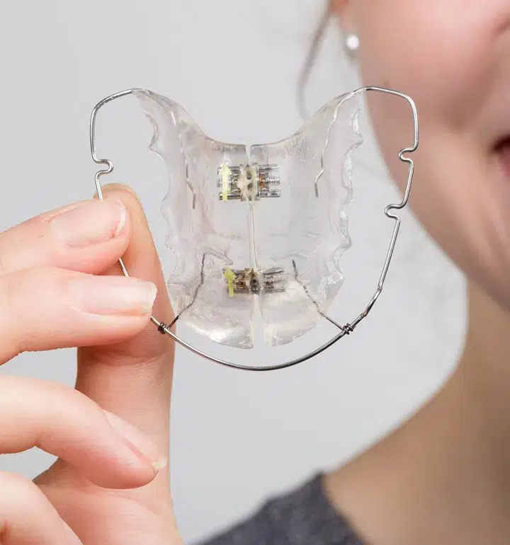 teeth retainers metairie at gallagher family dentistry