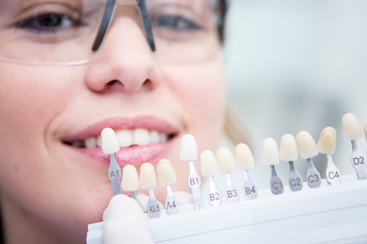 Veneers in Metairie